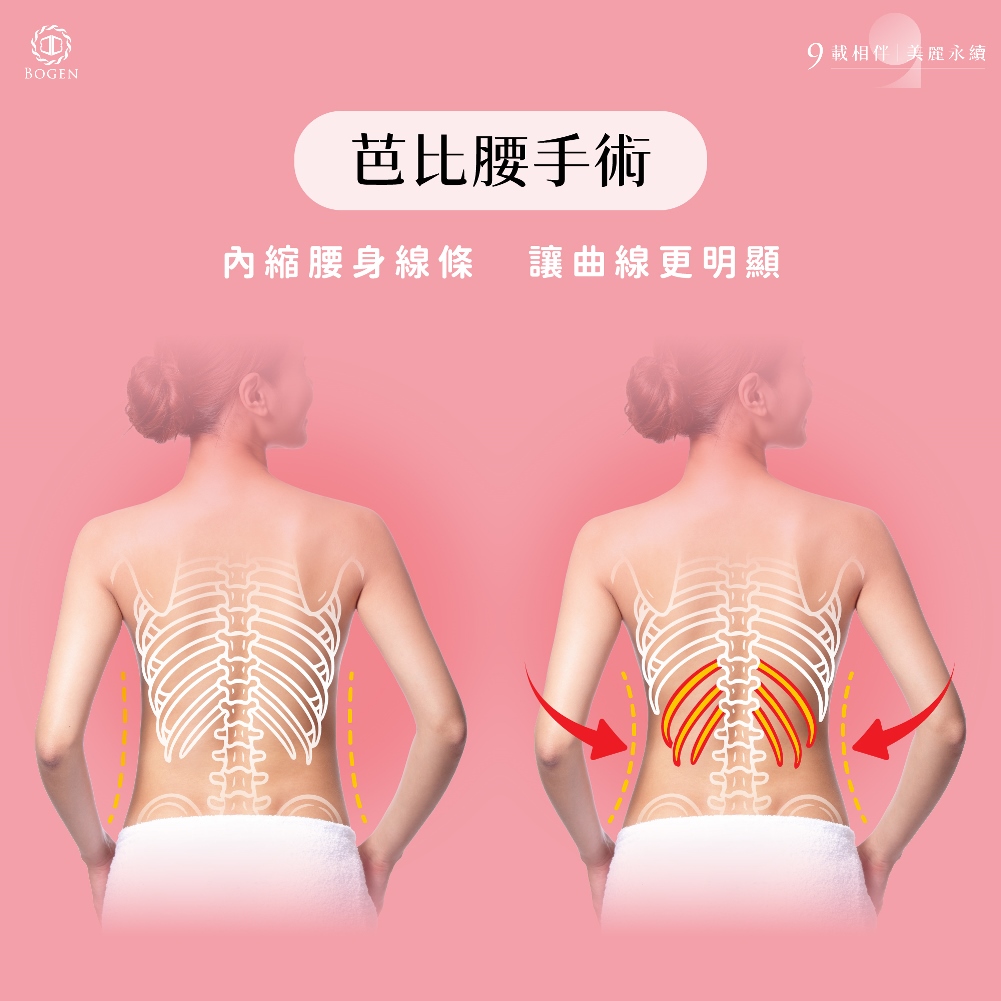 芭比腰手術,博恩妍